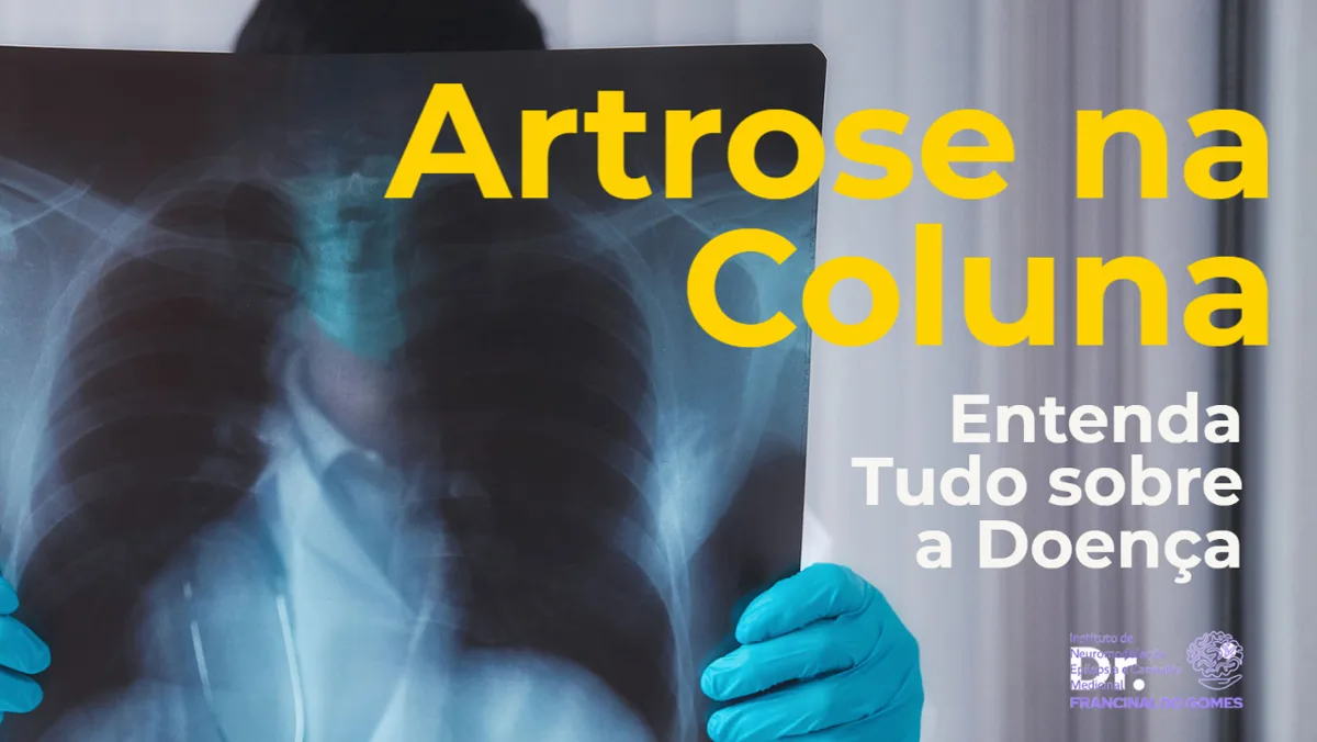 Artrose na Coluna: Sintomas, Causas e Tratamento
