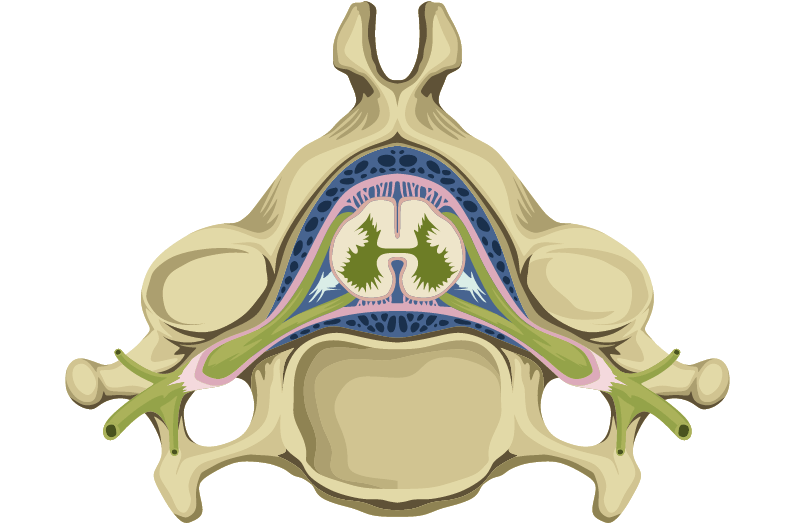 Atrofia muscular espinhal localização