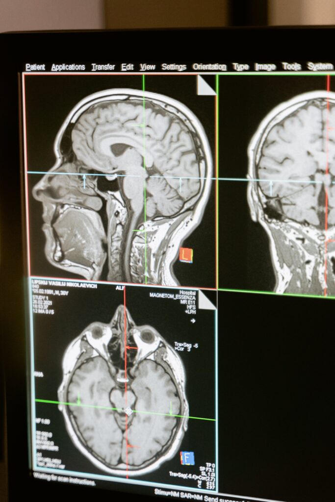 Neurocirurgião Explica o chip Neuralink.