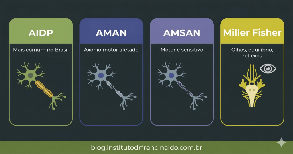 Infográfico comparativo dos quatro tipos de Síndrome de Guillain-Barré:
AIDP, AMAN, AMSAN e Síndrome de Miller Fisher