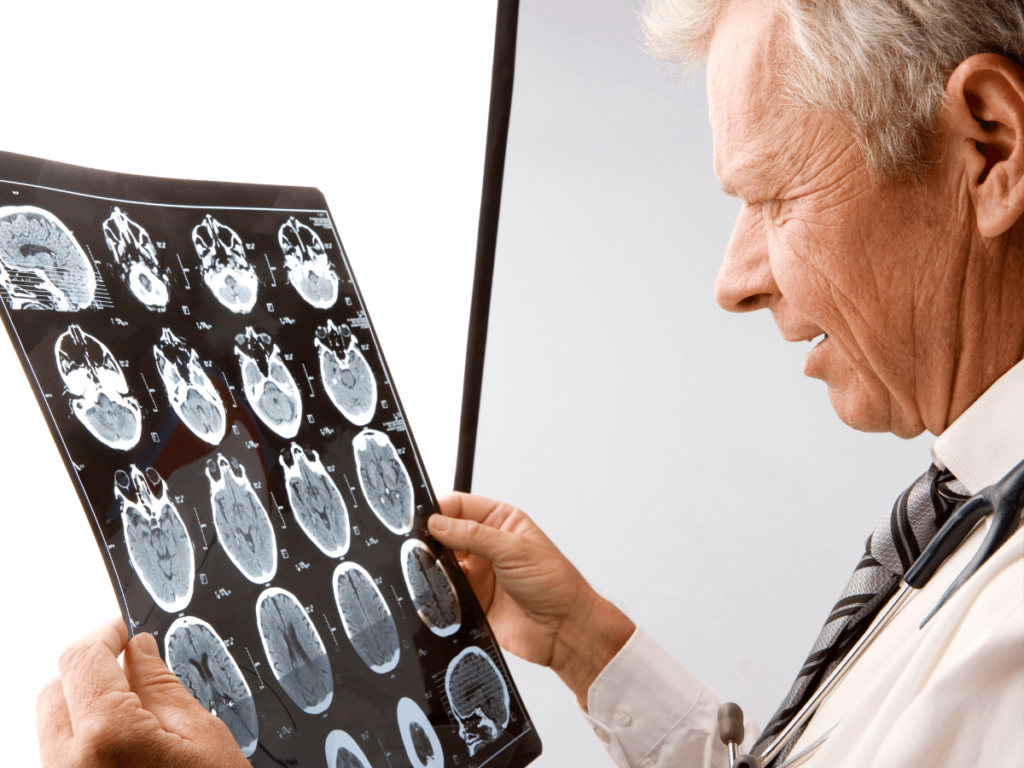 Médico analisando exame - Síndrome de Lennox-Gastaut
